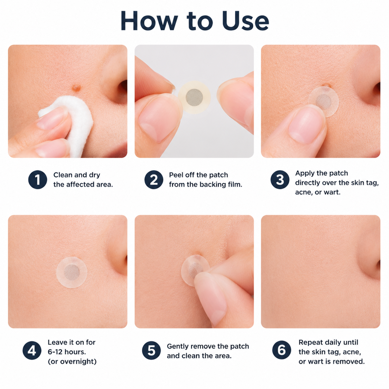 🔥 Curalona®2-in-1 Microneedle & Hydrocolloid Patch🔥| Removes Raised Moles, Acne, Flat Warts & Skin Tags | Helps Improve Wrinkles, Scars & Blemishes | Invisible Patches for Face & Body
