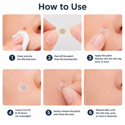 🔥 Curalona®2-in-1 Microneedle & Hydrocolloid Patch🔥| Removes Raised Moles, Acne, Flat Warts & Skin Tags | Helps Improve Wrinkles, Scars & Blemishes | Invisible Patches for Face & Body
