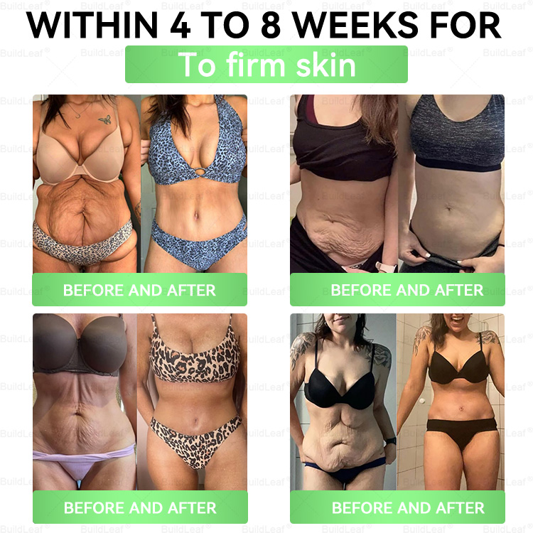 🔥𝘽𝙪𝙞𝙡𝙙𝙇𝙚𝙖𝙛® 𝗚𝗟𝗣-𝟭 𝟖-𝗶𝗻-𝟭 𝗦𝗹𝗶𝗺 & 𝑯𝒆𝒂𝒍𝒕𝒉𝐲 𝑶𝒓𝒂𝒍 𝑺𝒐𝒍𝒖𝒕𝒊𝒐𝒏 𝑂𝑛𝑐𝑒 𝑎 𝑑𝑎𝑦, 𝑣𝑖𝑠𝑖𝑏𝑙𝑒 𝑟𝑒𝑠𝑢𝑙𝑡𝑠 𝑖𝑛 7 𝑑𝑎𝑦𝑠)  ✅ 𝗦𝘂𝗽𝗽𝗼𝗿𝘁𝘀 𝗼𝗯𝗲𝘀𝗶𝘁𝘆, 𝗰𝗮𝗿𝗱𝗶𝗼𝘃𝗮𝘀𝗰𝘂𝗹𝗮𝗿 𝗵𝗲𝗮𝗹𝘁𝗵, 𝗱𝗶𝗮𝗯𝗲𝘁𝗲𝘀, 𝘀𝗹𝗲𝗲𝗽 𝗮𝗽𝗻𝗲𝗮, 𝗴𝘂𝘁 𝗵𝗲𝗮𝗹𝘁𝗵, 𝗷𝗼𝗶𝗻𝘁 𝗶𝘀𝘀𝘂𝗲𝘀, 𝐰𝐡𝐢𝐥𝐞 𝐚𝐥𝐬𝐨 𝐟𝐢𝐫𝐦𝐢𝐧𝐠 𝐭𝐡𝐞 𝐬𝐤𝐢𝐧 𝐚𝐧𝐝 𝐛𝐨𝐨𝐬𝐭𝐢𝐧𝐠 𝐞𝐧𝐞𝐫𝐠𝐲.